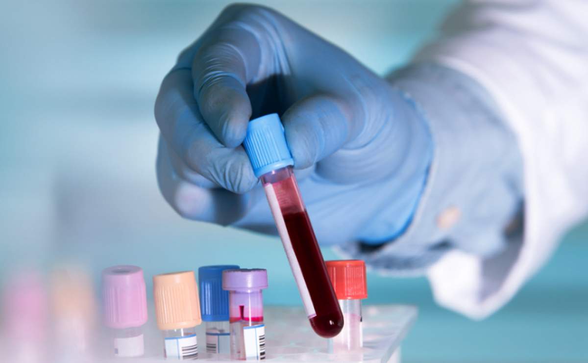 Cell Separation Technologies Market