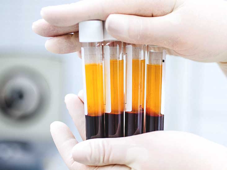 Platelet Rich Plasma Market Growth