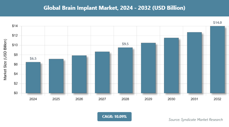 Global Brain Implant Market Size